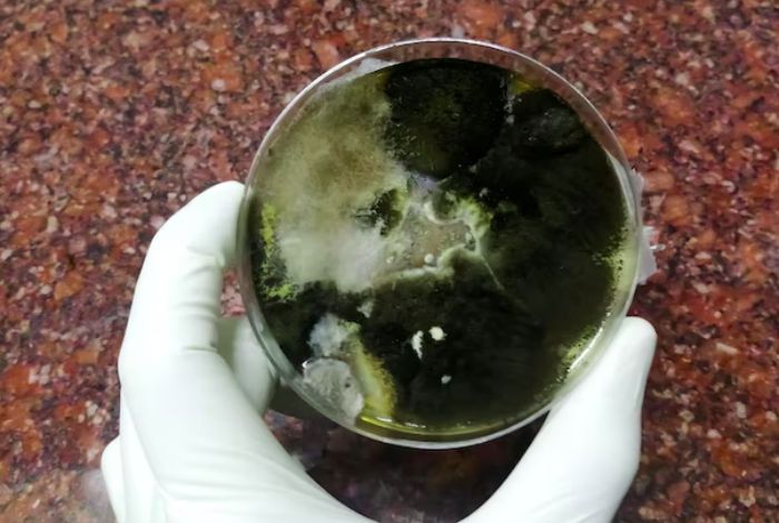 karakteristik bakteri tinja